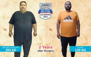 Bariatric Surgery in Jalandhar Punjab India