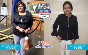 Mini Gastric Bypass Surgery Jalandhar Punjab