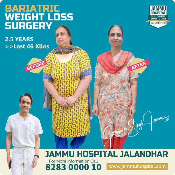 Bariatric Surgery Results