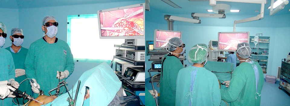 3D Technology Laparoscopic Surgery