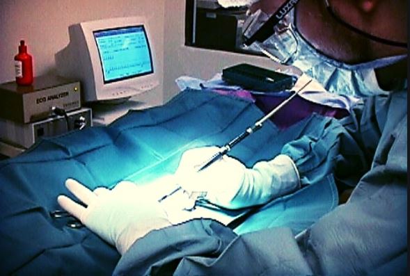 Best Laser Surgery Surgeon in Punjab