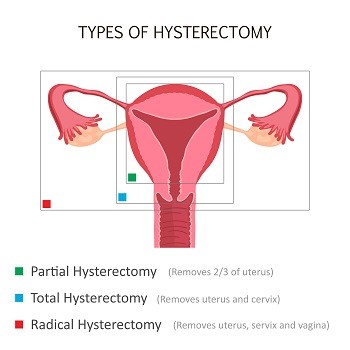 Laparoscopic Ovarian Hysterectomy Jalandhar Punjab