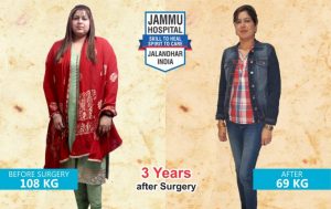 bariatric surgery india results