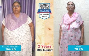 bariatric surgery india results