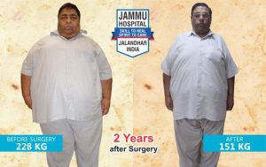 bariatric surgery punjab results 2