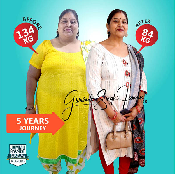 bariatric surgery in punjab