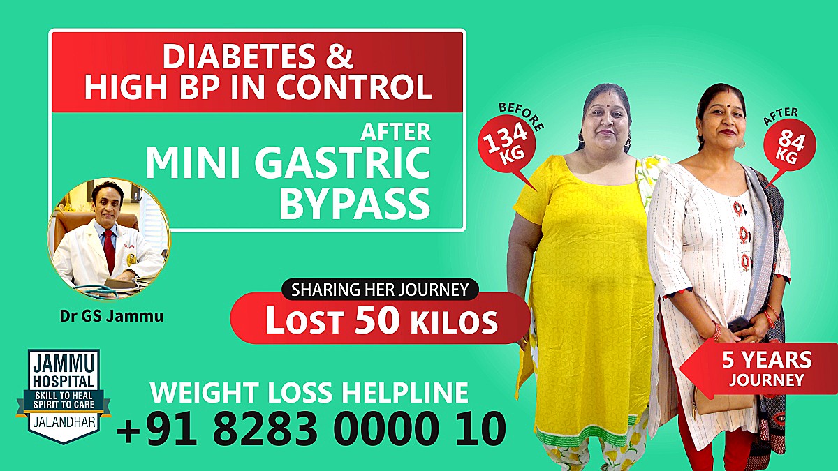 mini gastric bypass jalandhar punjab