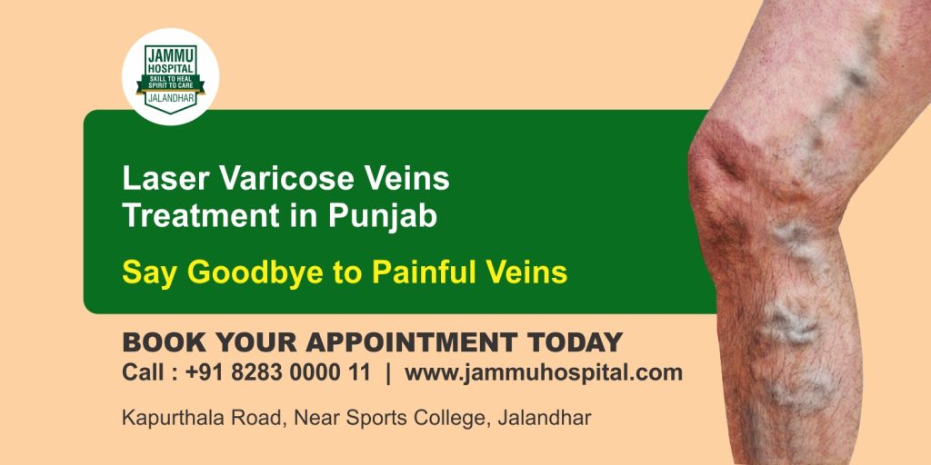 laser varicose veins treatment in punjab
